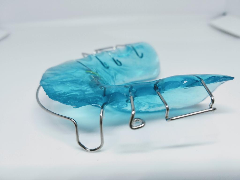 Individuell gefertigte blaue Zahnspange
